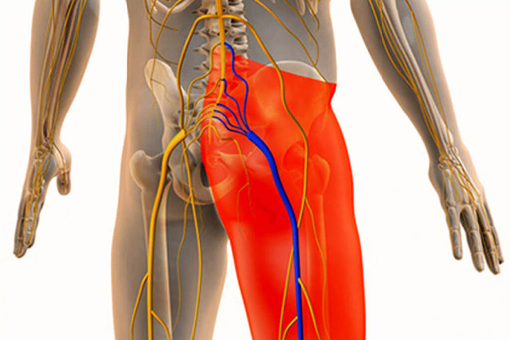 Simple Stretches to Ease Sciatica Before Seeing a Delhi Doctor